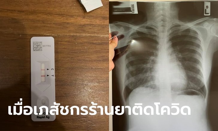 "เภสัชกร" ติดโควิด รีวิวการ Home Isolation รักษาเองจนหายใน 9 วัน