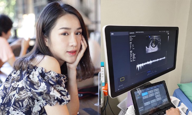 ท้องแล้วจ้า! "ฟ้าใส อรจิรา" นักแสดงสาว ภรรยาผู้ว่าอุดร เตรียมเป็นคุณแม่มือใหม่