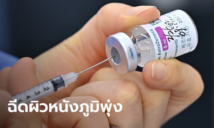 รพ.วชิระภูเก็ต เปิดผลฉีดแอสตร้าฯ เข็ม 3 เข้าผิวหนัง ใช้ปริมาณวัคซีน 20% ภูมิขึ้นสูง