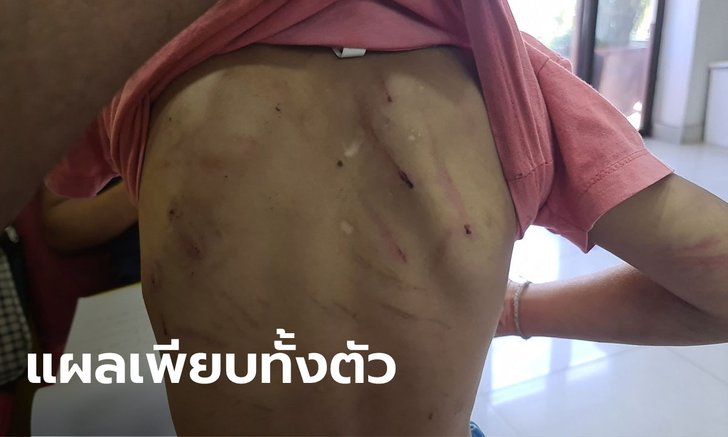 บุกช่วยเด็กชายวัย 6 ขวบ ถูกพี่สาวตียับแผลเต็มตัว อ้างน้องซนและดื้อ