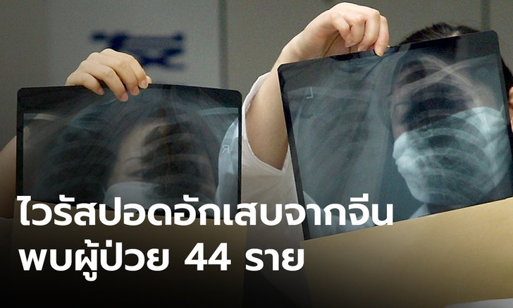 เฝ้าระวังโรคปอดอักเสบที่แพร่กระจายมาจากจีน พบแล้ว 44 ราย