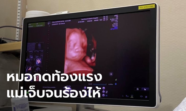 ว่าที่คุณพ่อใจสลาย เมียท้อง 6 เดือน แท้งลูกหลังอัลตร้าซาวด์ 4D ชี้หมอกดแรง-พูดหยาบ