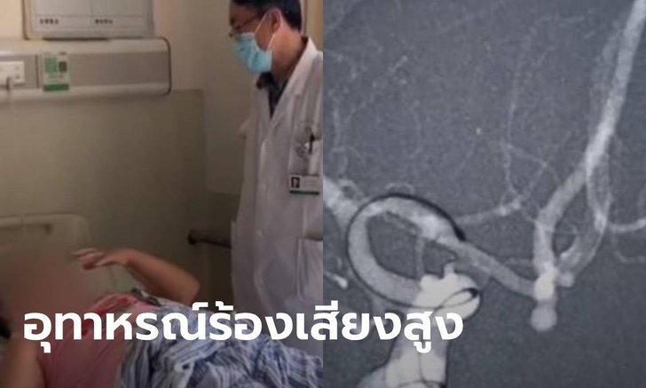 สาวเส้นเลือดในสมองแตก ขณะขึ้นเสียงสูง ร้องคาราโอเกะโชว์ญาติ