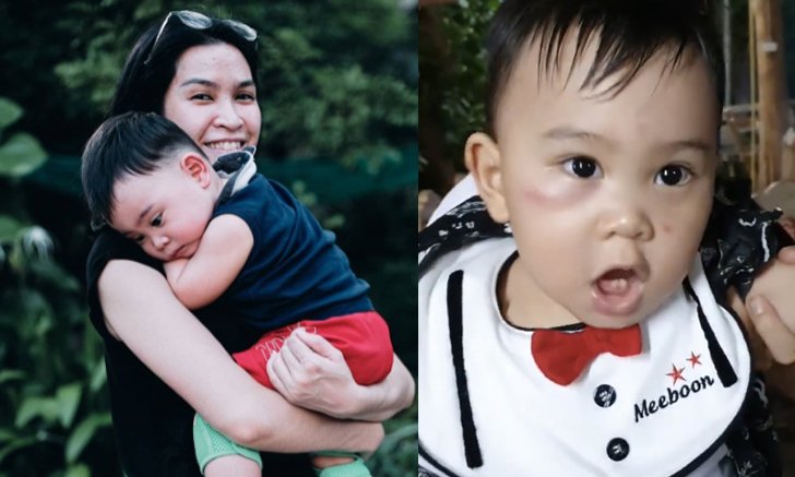 ทรมานใจแม่ "อีฟ พุทธิดา" เผยภาพ "น้องมีบุญ" หน้าบวมฉึ่งเพราะยุงทำพิษ
