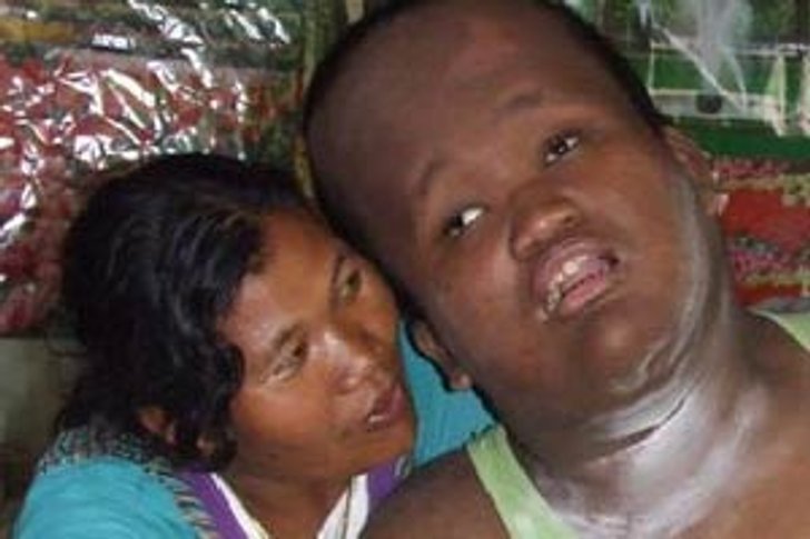 สุดยอดแม่! กัดฟันเลี้ยงลูกพิการนานกว่า 16 ปี