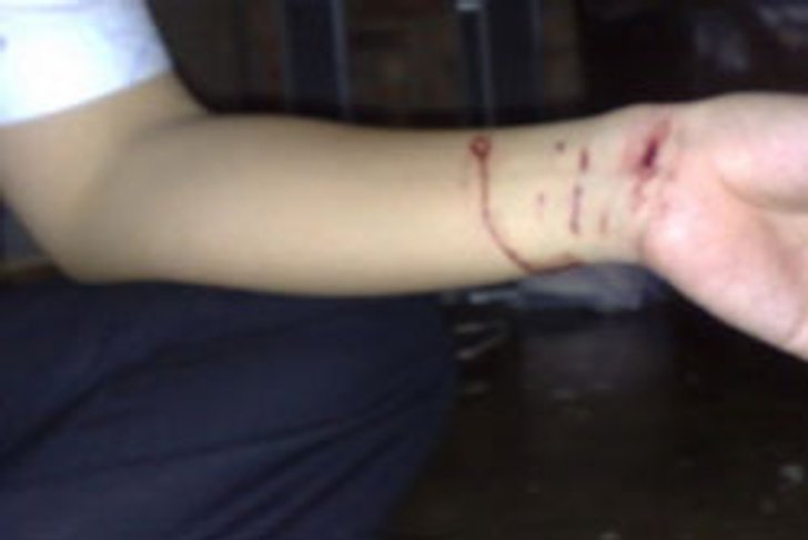 รวบ! หนุ่มสิงคโปร์ ซุกยาอี คลั่งโดนจับกรีดข้อมือโชว์