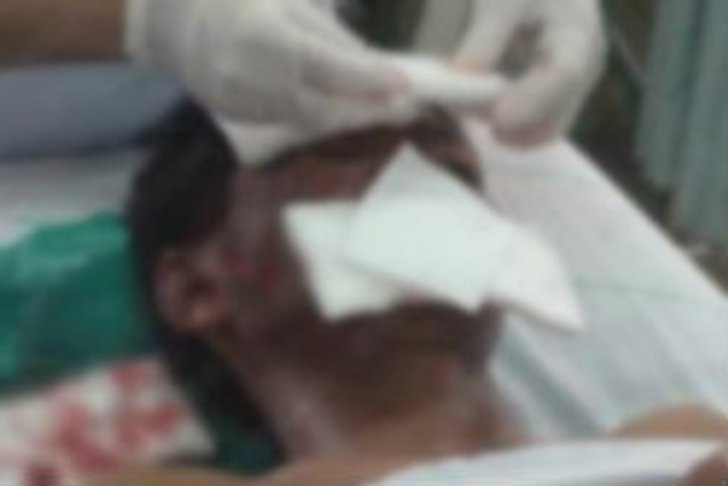 หนุ่มฮึดสู้หมีควาย ถูกตะปบปางตายเย็บนับ100เข็ม