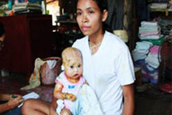 โผล่อีกราย! เด็กดักแด้ขวบเศษ วอนผู้ใจบุญช่วย