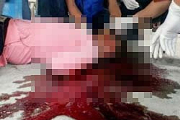 น้องโหด! โกรธพี่ชาย ใช้ปืนยิงเบ้าตาดับคาบ้าน