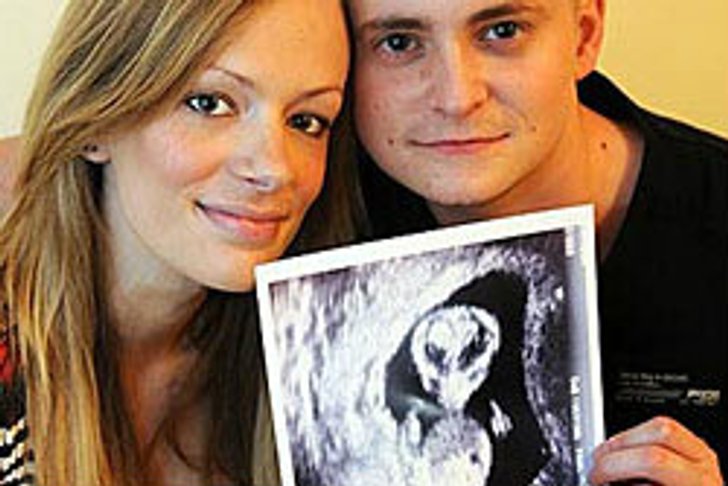 พ่อแม่ผู้ดีขำ! ภาพอัลตราซาวนด์ลูกคล้ายอีที