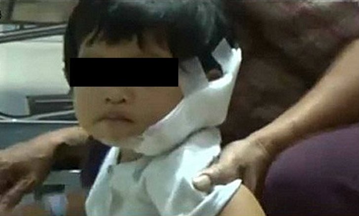 สุนัขลูกผสมพันธุ์บางแก้วขย้ำหนูน้อย เย็บกว่า 30 เข็ม