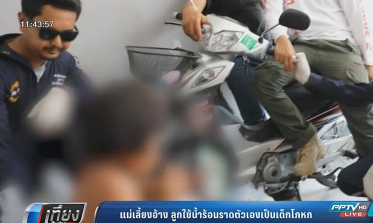 แม่เลี้ยงอ้าง ลูกใช้น้ำร้อนราดตัวเอง เป็นเด็กโกหก