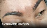 สาวผ่าตัดแก้หนังตาตก ทำเสร็จคิ้วโก่งเป็นงิ้ว อึ้ง พนักงานคลินิกรุมบูลลี่ ท้าให้ฟ้อง