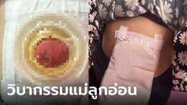 สาวสุดทรมาน หมอทำคลอดกรีดแผลยาวถึงทวาร ลำไส้แตก ทุกข์ซ้ำผัวทิ้งไปมีใหม่
