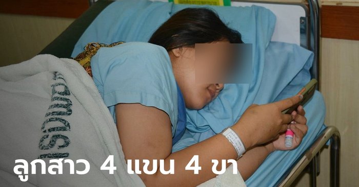 A hilarious woman in Nakhon Phanom gives birth to a daughter with 4 arms and four legs.  But the doctor kept a close eye