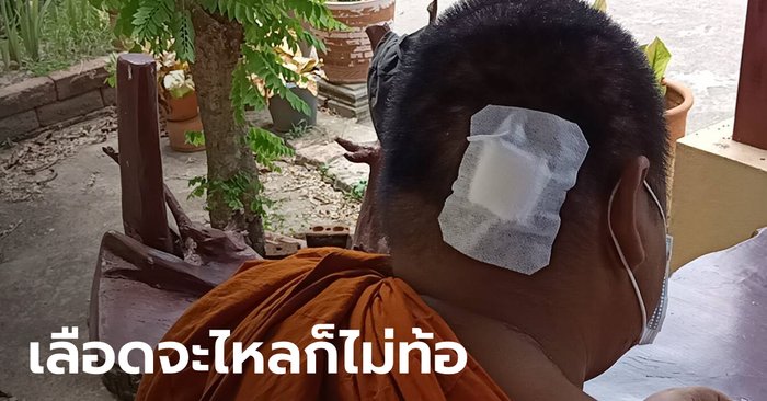 หนุ่มหลอนยา คว้าหินทุบหัวพระขณะบิณฑบาต หลวงพี่กัดฟันให้พรต่อจนจบ