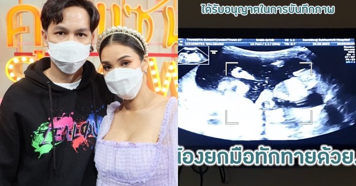 "ชมพู่ ก่อนบ่าย" ท้องลูกคนที่ 2 เผยไม่รู้ตัวจนเข้าเดือนที่ 4 เล่าความฝันบอกเหตุ