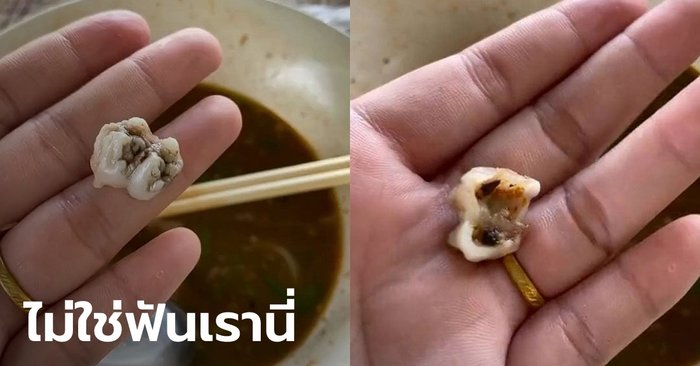 อวสานคำสุดท้าย สาวเพิ่งเห็นมีฟันซี่ใหญ่ในชามก๋วยเตี๋ยว สงสัยมันคืออะไร