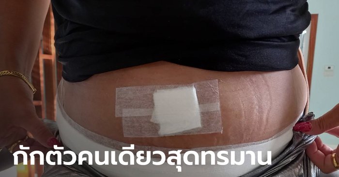 หญิงบุรีรัมย์โวย ไปผ่าตัดใหญ่ที่ กทม. ถูกสั่งห้ามกักตัวที่บ้าน ผู้ใหญ่บ้านอ้างกฎก็คือกฎ