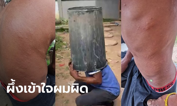 หนุ่มเล่านาทีเอาชีวิตรอด ผึ้งหลวงกว่า 400 ตัว รุมต่อย เกือบตายเพราะผึ้งแค้นผิดคน