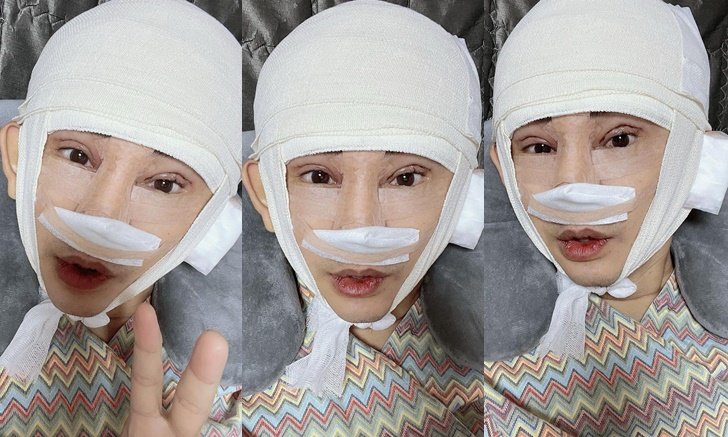 "พชร์ อานนท์" เปิดหน้าใหม่หลังออกจากห้องผ่าตัด ตอบคำถามตรงๆ กลัวคนบูลลี่มั้ย?