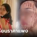พิธีกรสาวเปิดแผลโชว์ คลินิกทำหน้าไหม้ เจ็บเหมือนเตารีดนาบ คำอ้าง พนง.ฟังไม่ขึ้น