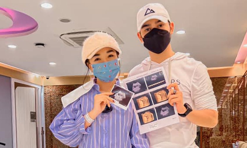 คุณพ่อคุณแม่มือใหม่ &quot;เจนนี่-ยิว&quot; อวดภาพอัลตร้าซาวด์ลูก เฉลย