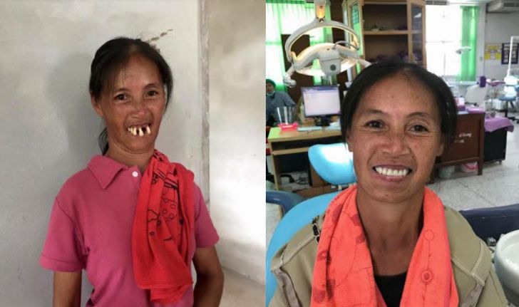 ยิ้มไม่หุบ สาวใบ้ขอทำบัตรประชาชนใหม่ หลังทำฟันพลิกชีวิต