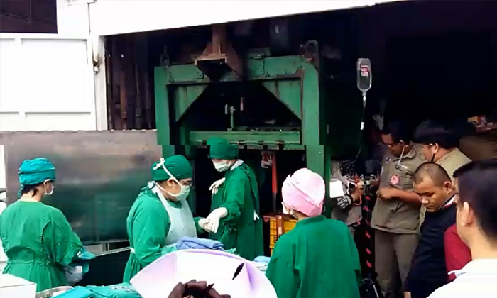 หนุ่มเคราะห์ร้าย แขนติดเครื่องอัดกระดาษ แพทย์ตัดทิ้งรักษาชีวิต