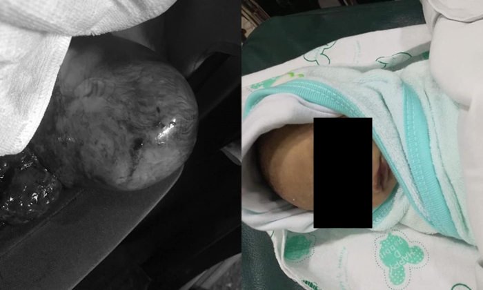 สาวปวดใจ! หลานติดในถุงน้ำคร่ำ รถพยาบาลรอนาน-ตำรวจเมินช่วย จน "ตาย" ไม่ทันลืมตาดูโลก