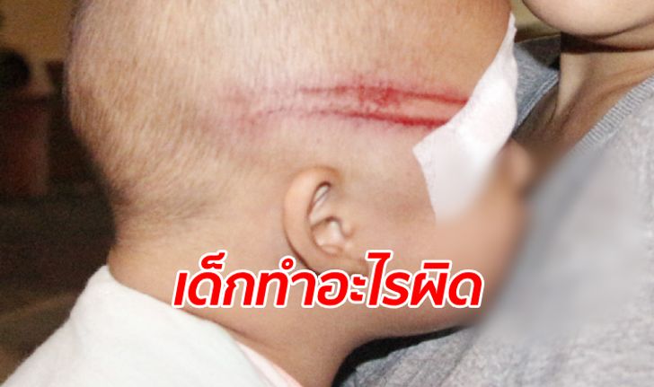 พ่อแม่วนรถหลบด่าน เจออาสาตำรวจฟาดกระบองใส่ ลูกชาย 2 ขวบสลบ-อ้วกไม่หยุด