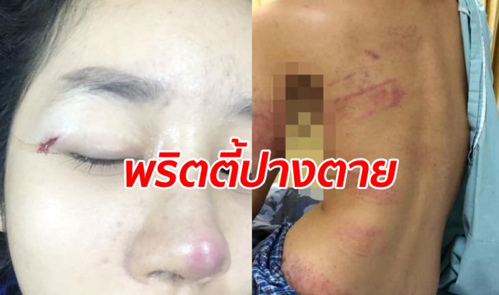 พริตตี้สาวปางตาย อดีตแฟนทุ่มทีวีใส่-ราดน้ำมันเตรียมจุดไฟ ส่งข้อความขู่ "กูล่ามึงแน่"