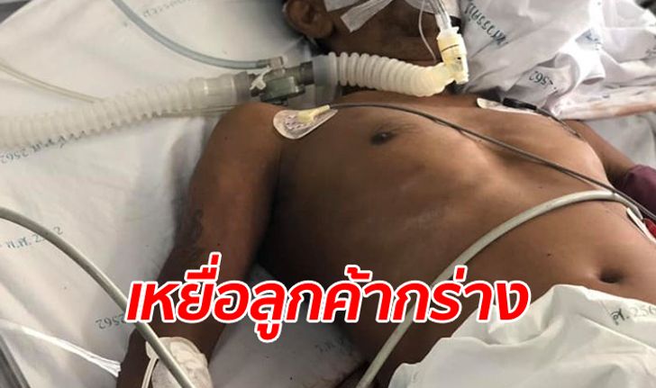 พนักงานรีสอร์ทถูกลูกค้ากระทืบ 3 รุม 1 เพราะไม่รู้จัก ปวดหัวรุนแรง เสียชีวิตแล้ว