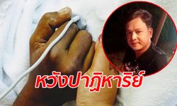 หมอให้ทำใจ "เชิด ร็อคแสลง" เส้นเลือดที่หลอดอาหารแตก 7 จุด ศิลปินระดมเงินช่วย