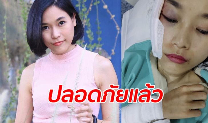 เจ้าหญิงแอนดรอยด์ "เก่ง กวิสรา" อุบัติเหตุปอร์เช่ชนต้นไม้ ปลอดภัยแต่ยังจำไม่ค่อยได้