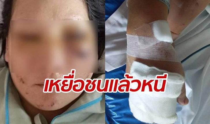 วอนพลังโซเชียลตามหา "กระบะตีนผี" ชนแล้วหนี สาวใหญ่เจ็บปางตาย