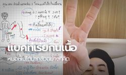 เพจหมอแชร์วิธีรับมือ "แบคทีเรียกินเนื้อคน" โรคเดียวกับ "บอย ปกรณ์" ติดเชื้อ