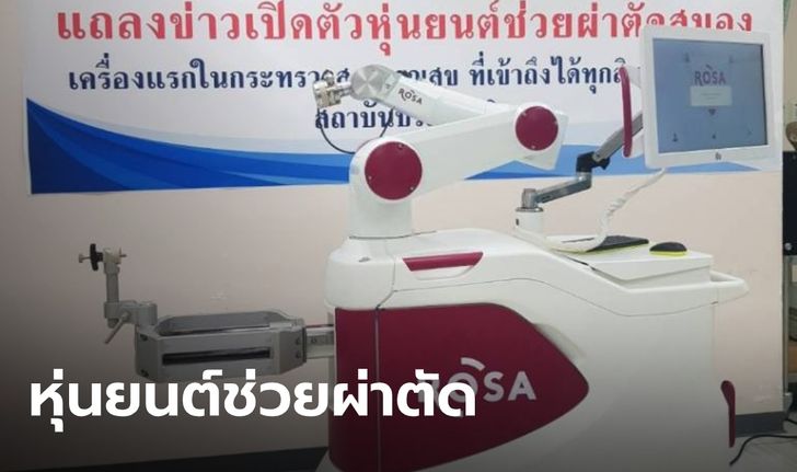 กรมการแพทย์ เปิดตัว "หุ่นยนต์ช่วยผ่าตัดสมองผู้ป่วยโรคลมชัก" เครื่องแรกของประเทศไทย