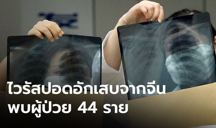 เฝ้าระวังโรคปอดอักเสบที่แพร่กระจายมาจากจีน พบแล้ว 44 ราย