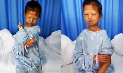 สุดสลด นศ.สาวจีนอดอาหาร 5 ปี เก็บเงินรักษาน้องชาย เสียชีวิตแล้วหลังโรครุมเร้า