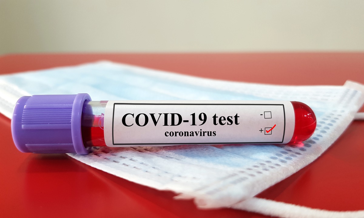 อังกฤษเตรียมตรวจสอบชุดตรวจแอนติบอดี้ “ไวรัสโคโรนา” ราคาย่อมเยา