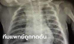 หมอโพสต์อัดอั้น ทารกเข้าข่ายโควิด-19 แต่ทางจังหวัดไม่ให้ส่งตรวจ หวั่นระบาดรอบสอง