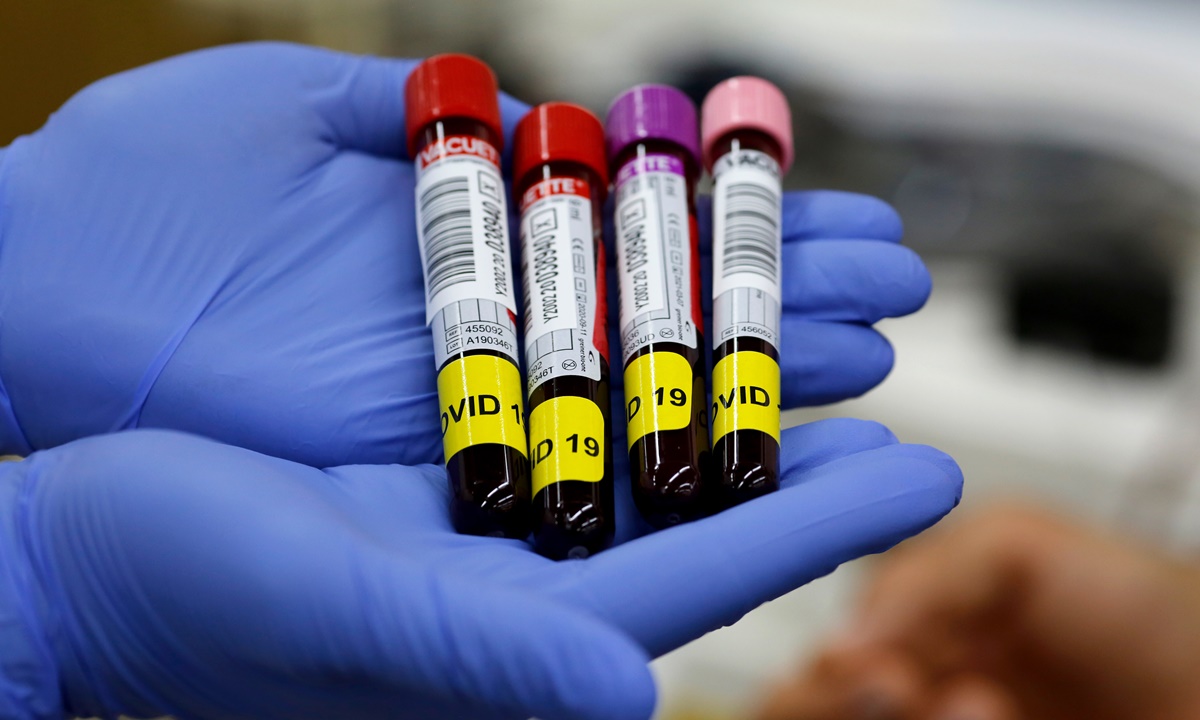 บริษัทยาสหรัฐฯ เล็งทดสอบ “พลาสมาเลือดวัว” ในมนุษย์ หวังรักษาโควิด-19