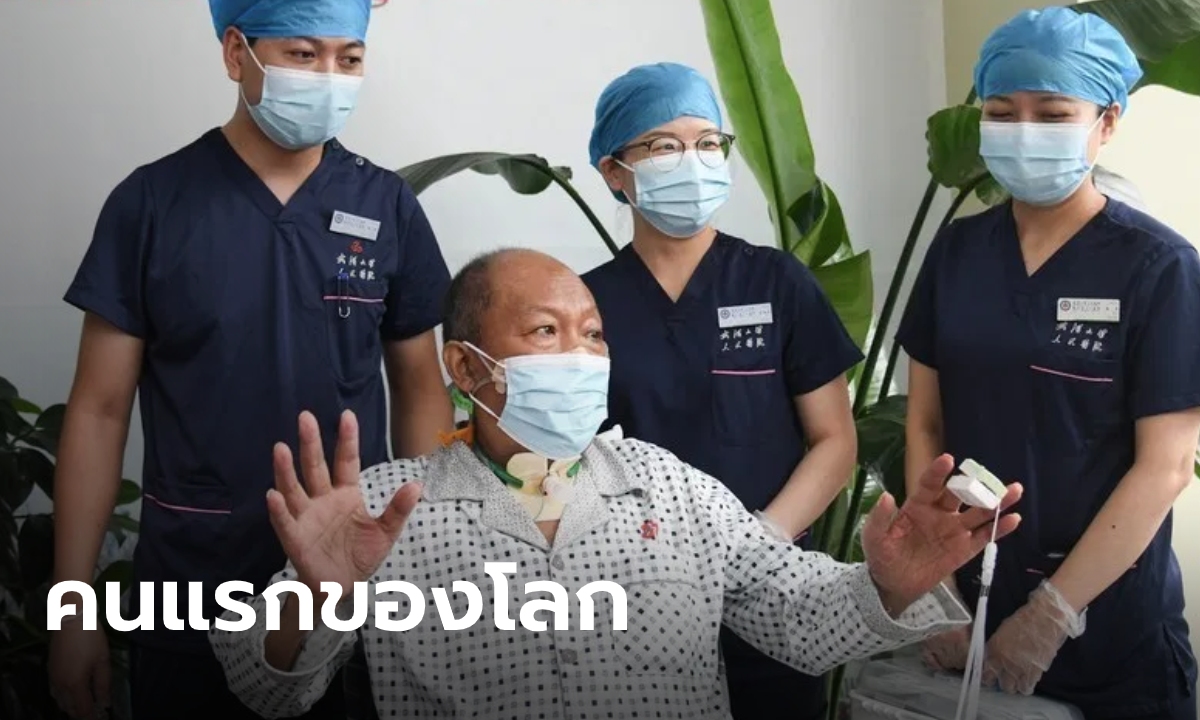 ผู้ป่วยโควิดในจีนได้รับการ "ปลูกถ่ายปอด" จนหายดี เป็นรายแรกของโลก