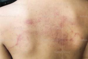 ผอ.โรงเรียนเร่งสอบกรณีครูทำร้ายเด็ก ม.2