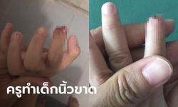 ครูอ้างลมพัดประตู หนีบมือเด็ก 3 ขวบ "นิ้วขาด" แม่ดูภาพวงจรปิดเห็นชัดๆ ตั้งใจปิดประตูใส่