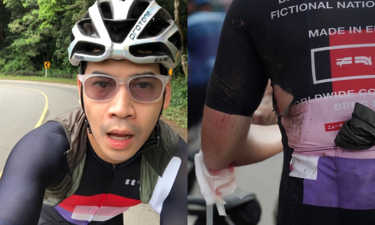 คนแห่เป็นห่วง "ฟรอยด์ ณัฏฐพงษ์" โชว์แผลสดเลือดอาบอุบัติเหตุจักรยานล้ม