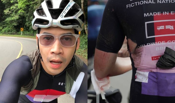 คนแห่เป็นห่วง "ฟรอยด์ ณัฏฐพงษ์" โชว์แผลสดเลือดอาบอุบัติเหตุจักรยานล้ม