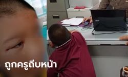 ยายพาหลาน 5 ขวบ ร้องปวีณา ถูกครูประจำชั้นถีบหน้า แถมให้เพื่อนนักเรียนรุมเตะต่อย