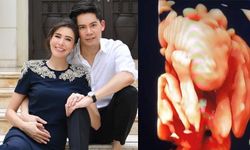 "กรณ์ ณรงค์เดช" เผยภาพลูกในท้อง "ศรีริต้า" แซวเจ้าตัวเล็กจือปากใส่พ่อแม่